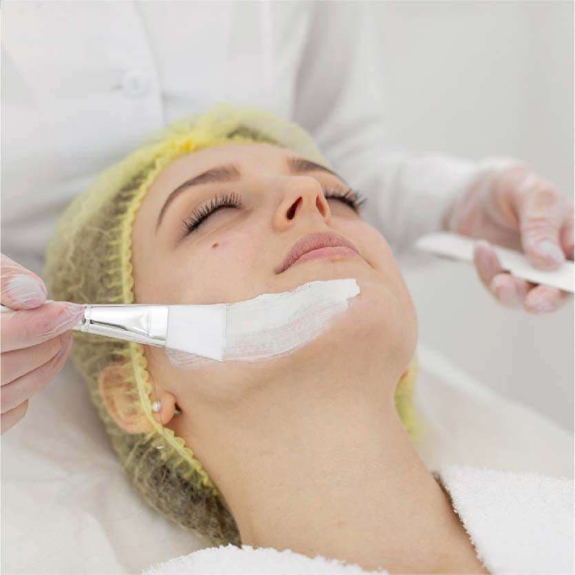 Chemical Peels in Indore at Skintimacy