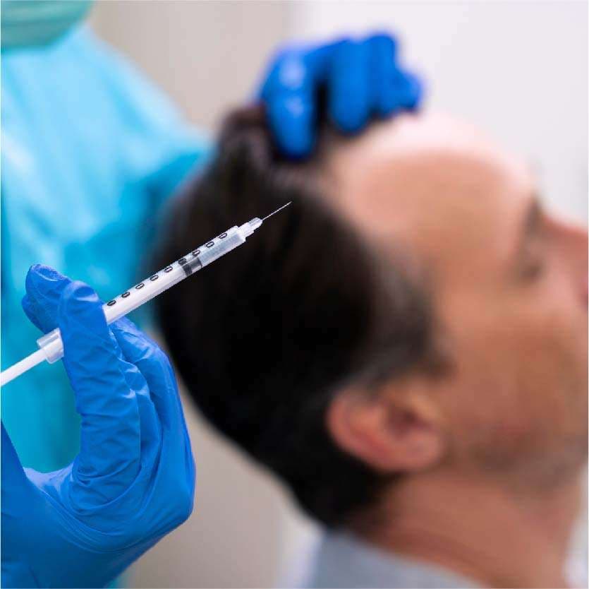 Hair PRP in Indore at Skintimacy