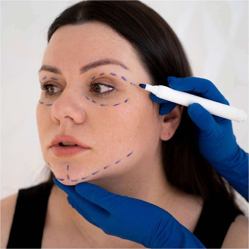 Thread Lift in Indore at Skintimacy